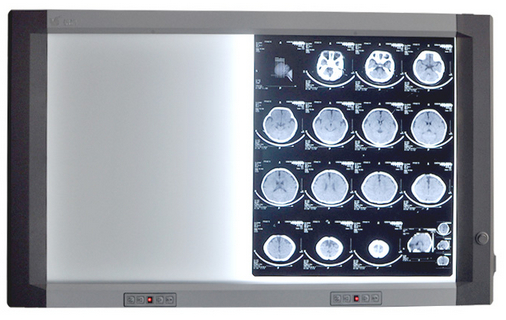 led雙聯(lián)觀片燈 led雙聯(lián)觀片燈