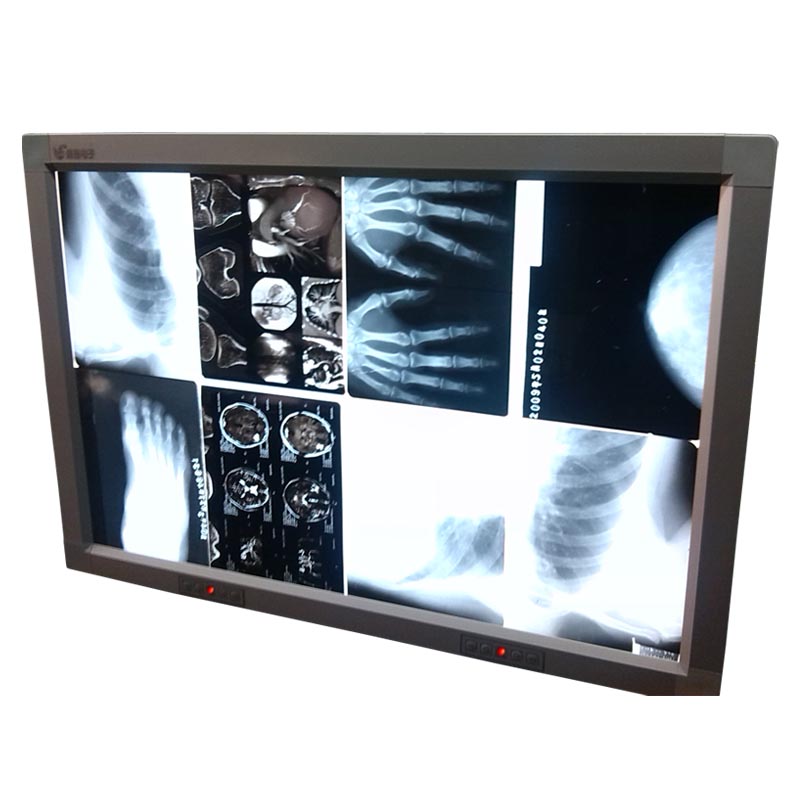 乳腺觀片燈 乳腺觀片燈